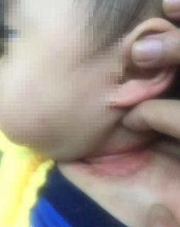 淹脖子/湿疹/痱子/蚊子包全来？稳住，咱有招！