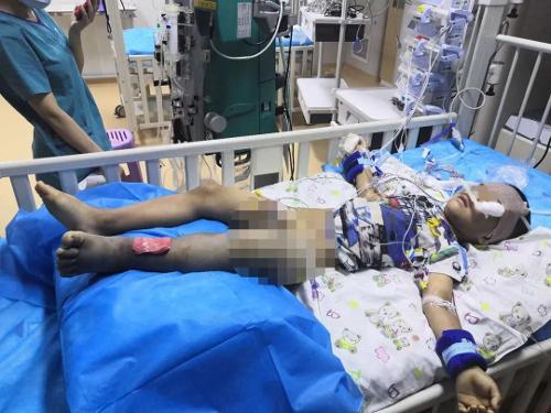 踩一脚，白山6岁淘气娃休克入院，这东西能随便踩吗？！