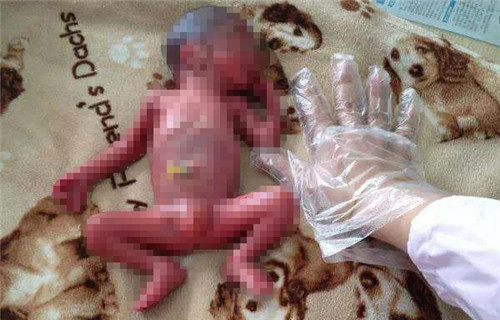 暖哭！世界早产儿日，读懂儿医这群人的63年！