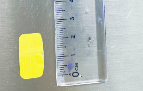 啥都敢给孩子玩？看看这两个案例吓人不！