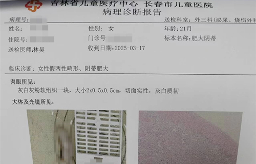 首例“女性假两性畸形”治愈，a片网站
又“上大分”！